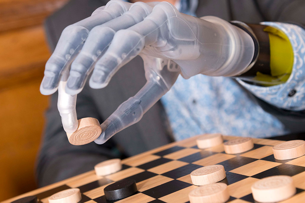 Touch Bionics Hand by Ossur