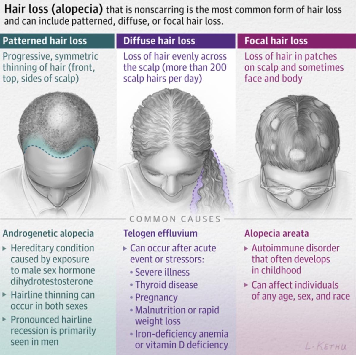 Aggregate 72+ weight loss and hair loss latest in.eteachers