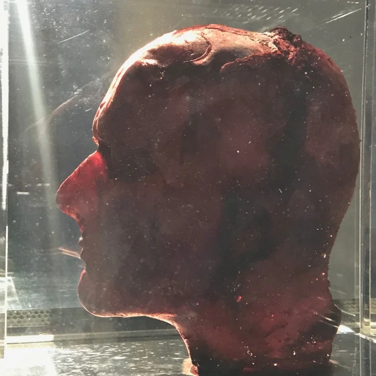 Marc Quinn, Self . Blood (artist’s), stainless steel, Perspex and refrigeration equipment, 6'10" × 2' × 2'.