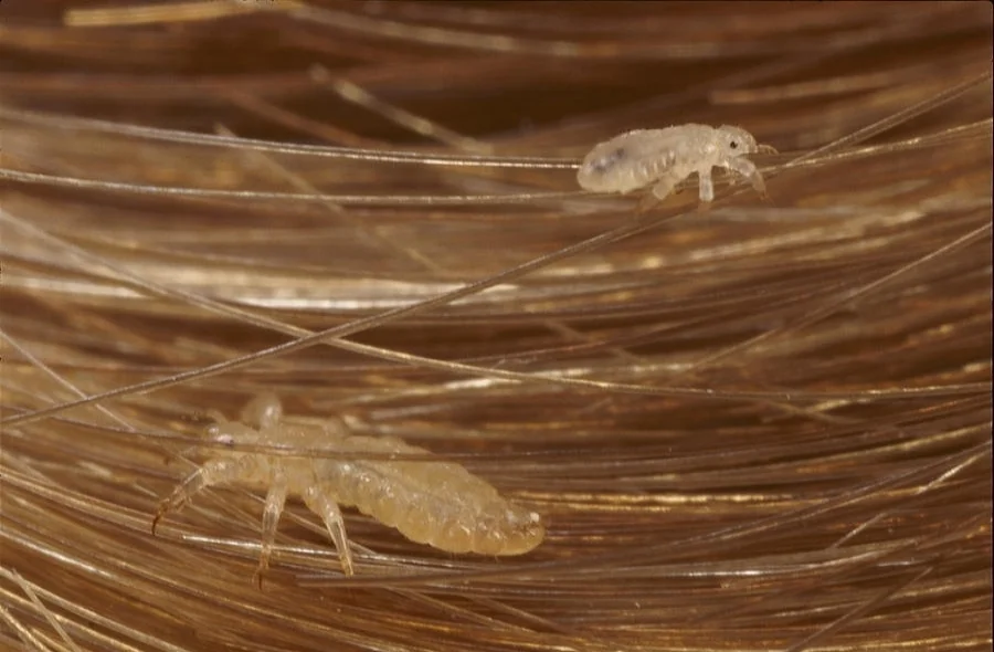 head-lice-pediculus-capitis-crawling-darlyne-a-murawski.jpg