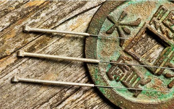 acupuncture.jpg