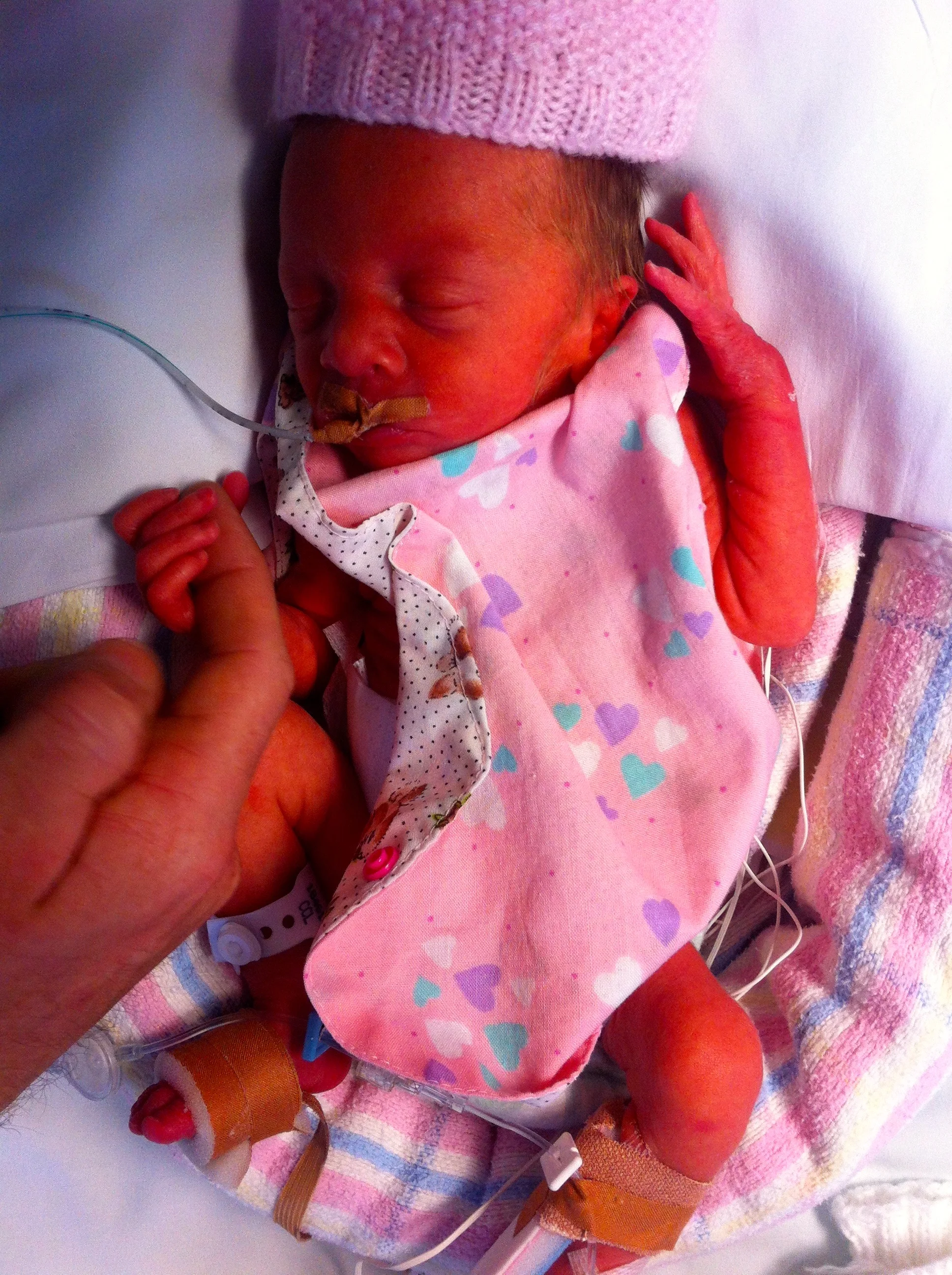 Premature Delivery 29 weeks.jpg