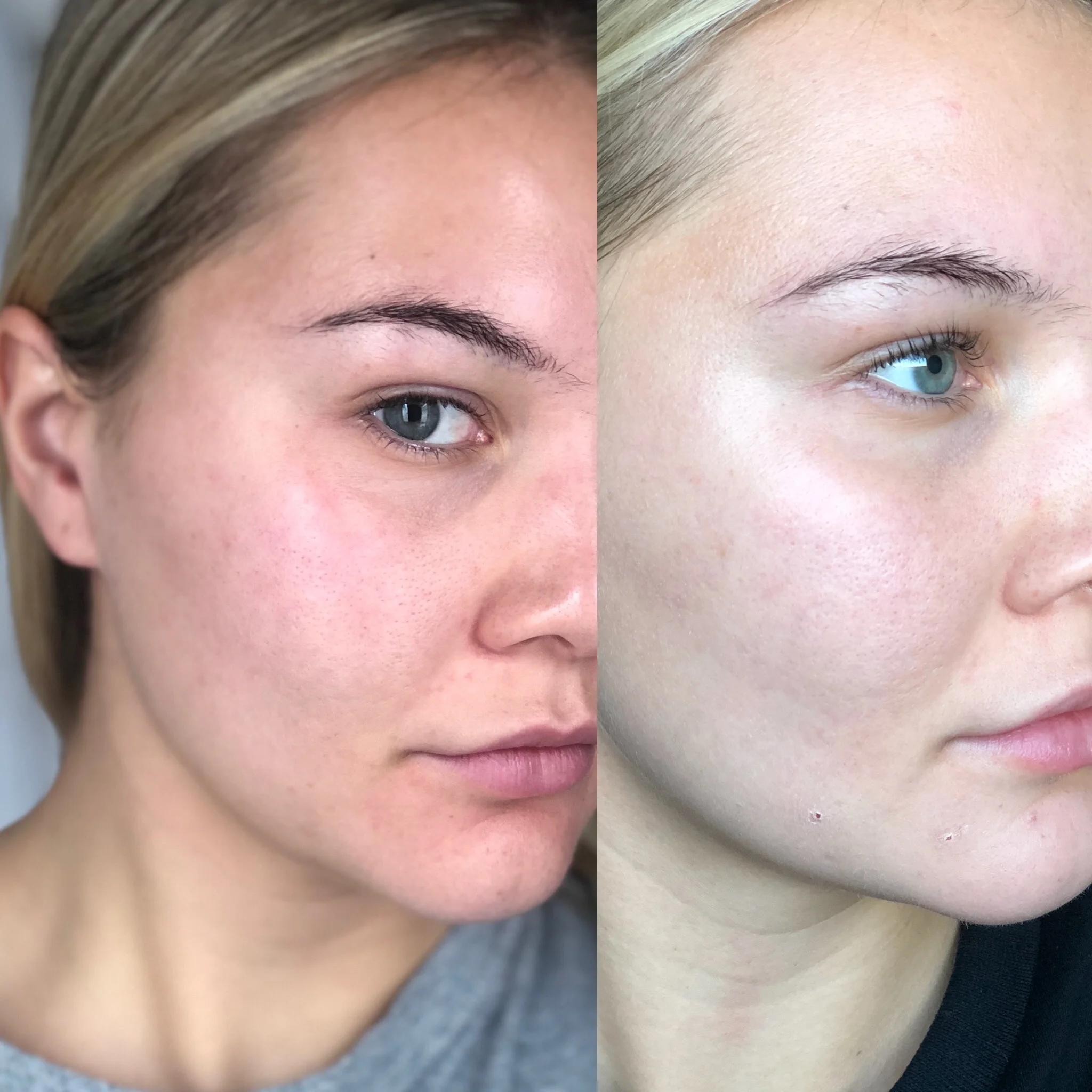 clear skin clinic double bay