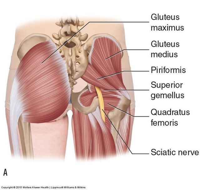 Piriformis syndrome is a condition in which the piriformis muscle, located in the buttock region, spasms and causes buttock pain. The piriformis muscle can also irritate the nearby sciatic nerve and cause pain, numbness and tingling along the back of