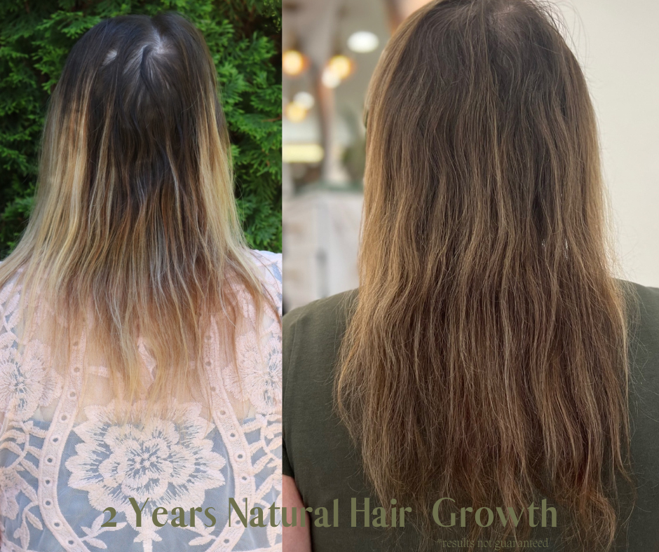 AnnieHairGrowth.png