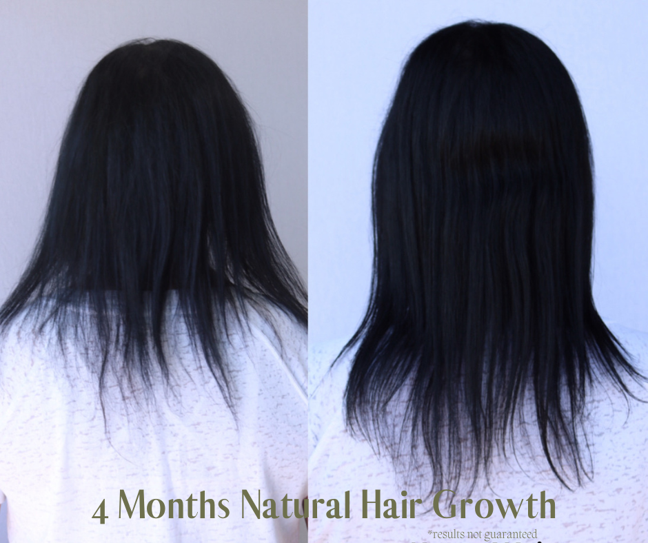 GinaHairGrowth.png
