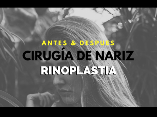 Rhinoplasty / Nose Surgery