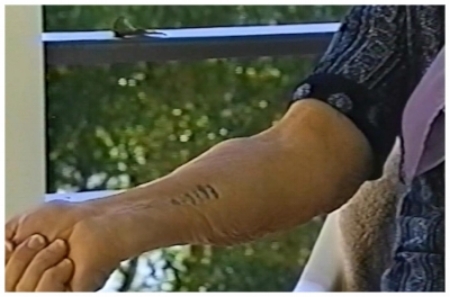 Kathy Bielik displays her Auschwitz identification tattoo as part of her Shoah Foundation testimony.
