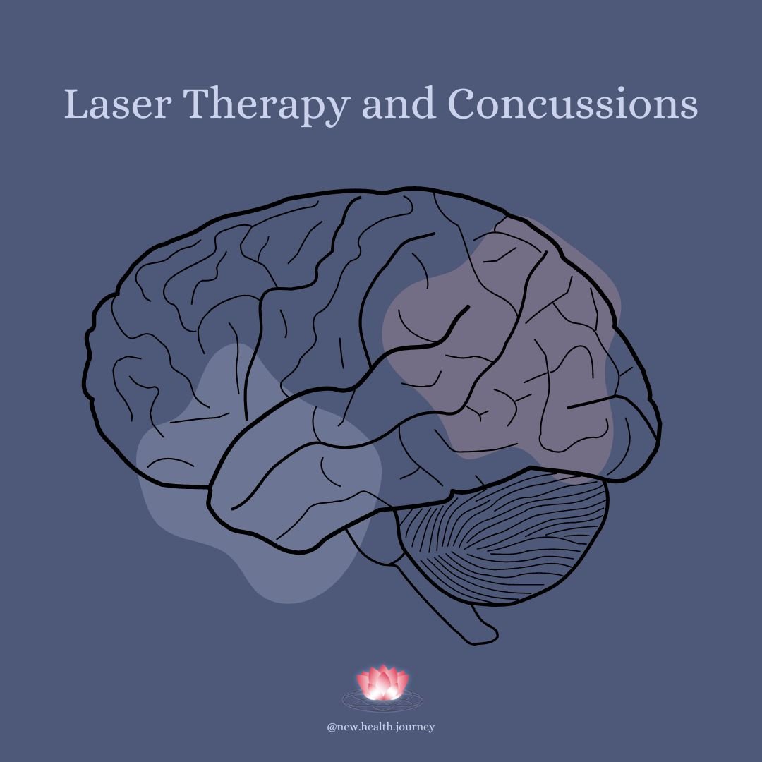 Laser Therapy and Concussions.jpg