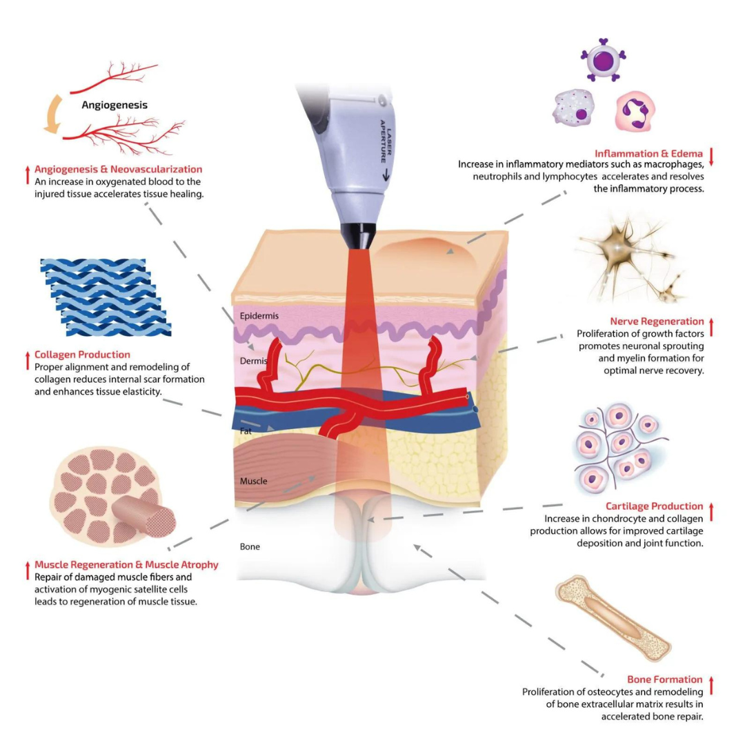 Photobiomodulation Treatment