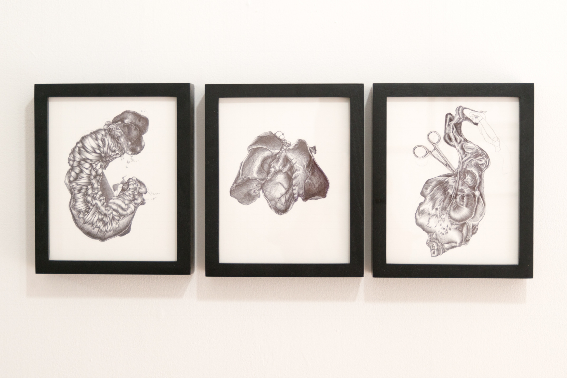 Doreen Garner, Medical Study 7-9 , ink on paper, 5 x 8 inches each. Image courtesy of Larrie.