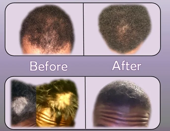 elixir results.JPG