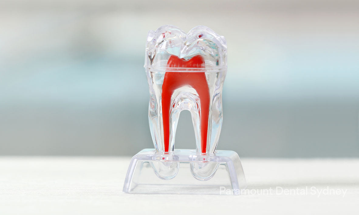 Pulp Extirpation Save Your Teeth Proven Track Record — Paramount