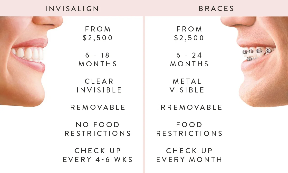 © Paramount Dental Sydney Invisalign vs Braces 06.jpg