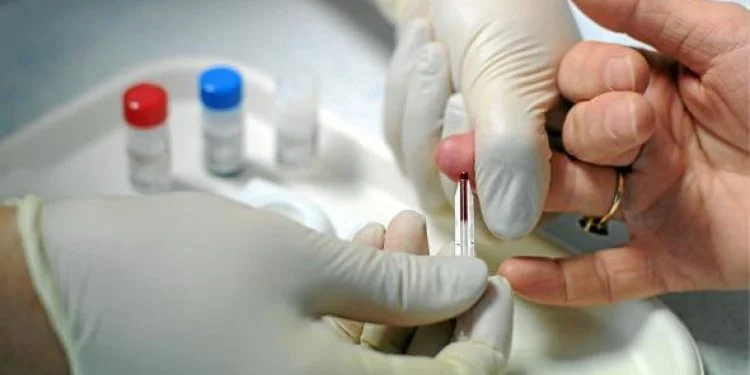 76 personas accedieron al Test Rápido del VIH en Laguna Avendaño