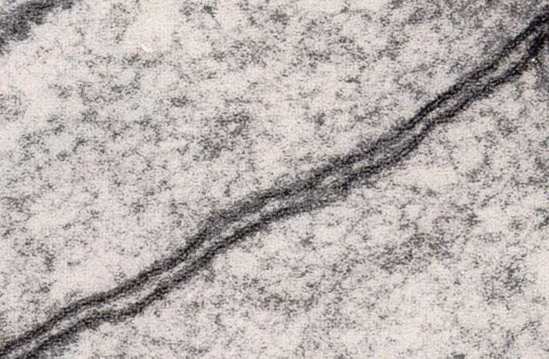 Electron-micrograph of a cell membrane. This image is at the extreme upper limits of electron microscopy resolution. In terms of the accuracy/veracity of the image: keep in mind that preparations must be sliced, freeze-dried in a vacuum, and sprayed with gold, or other heavy metal, in order to deflect electrons that can be detected.