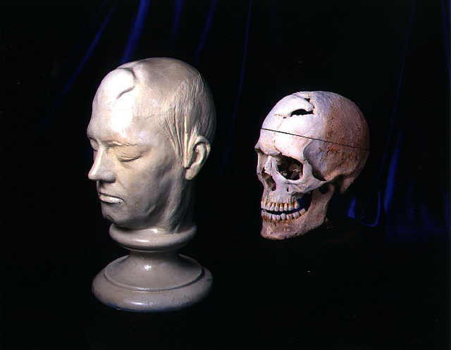 Phineas Gage's skull and life mask, Francis A. Countway Library of Medicine, Warren Anatomical Museum, Harvard. Photo: Graham Gordon Ramsay
