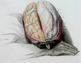 ChasBellBrain_small.jpg
