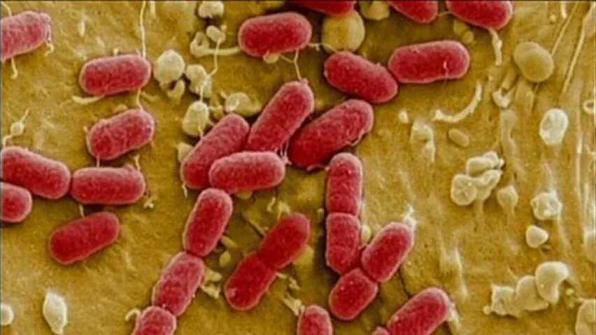 hi-nb-e-coli-fredericton.jpg