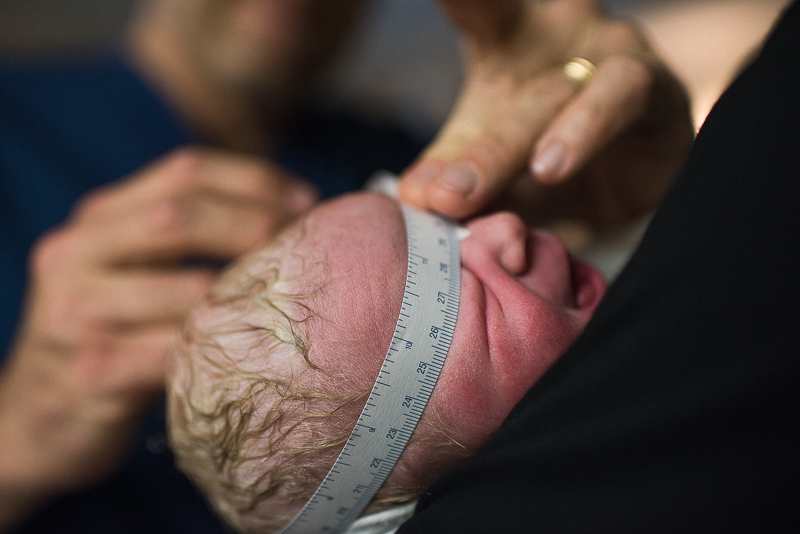 newborn baby has his head circumference measured