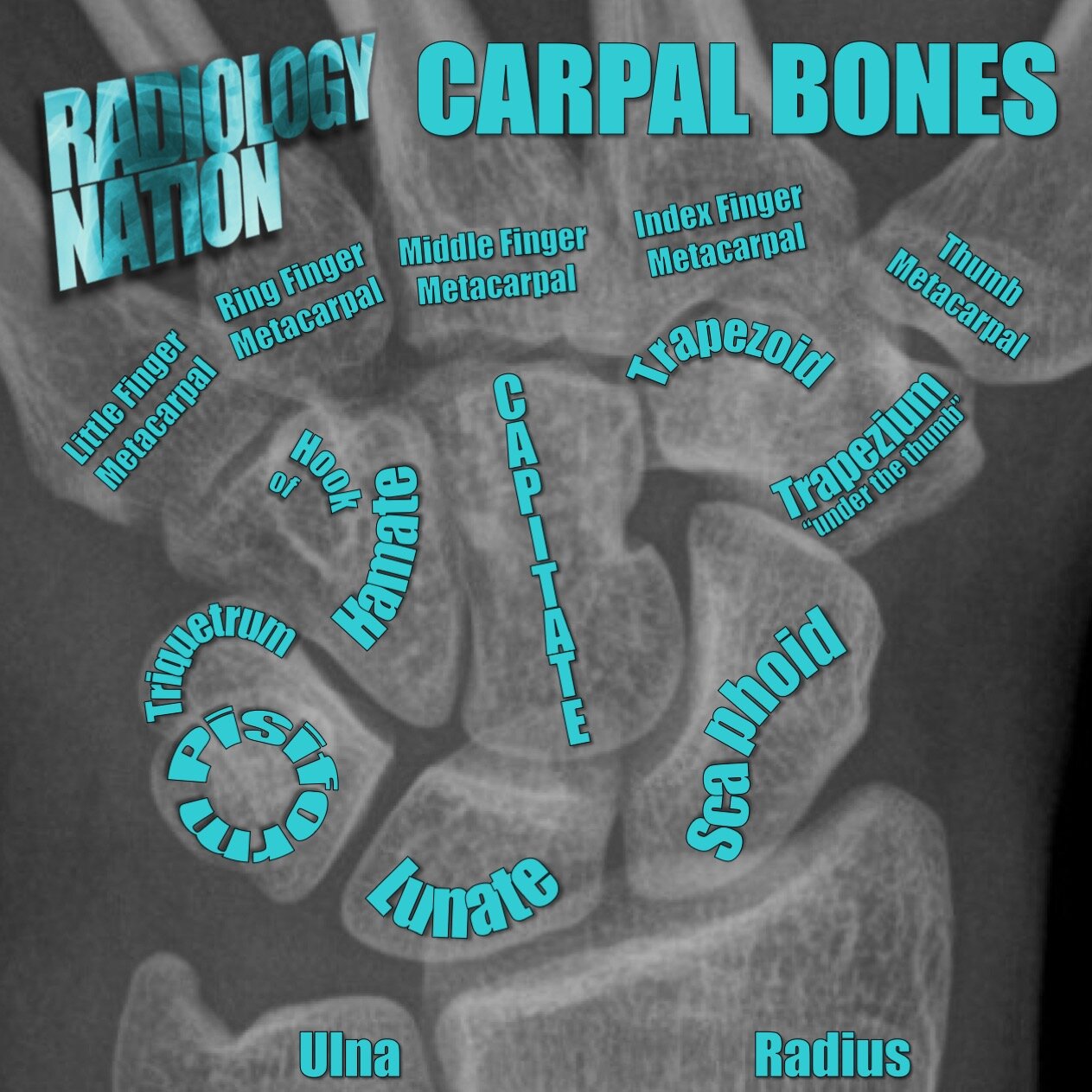 Carpal bone ossification16.jpeg