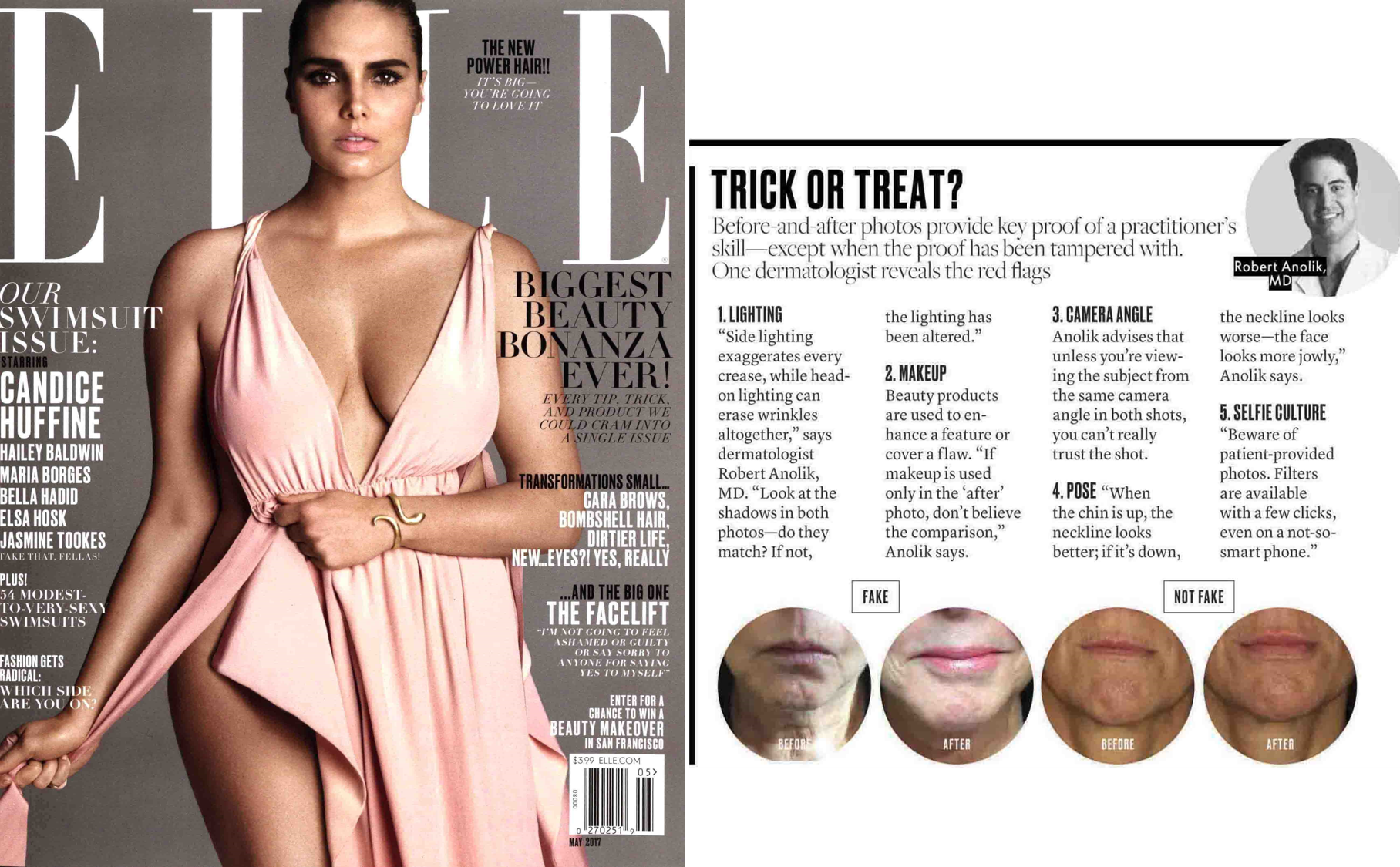 Elle_5-17_Sure_Shots_Dr Robert Anolik_Large Feature.png