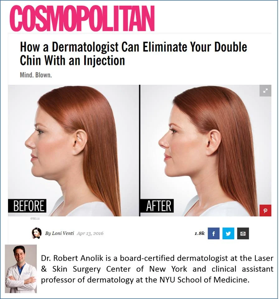 How a Dermatologist Can Eliminate Your Double Chin With an Injection featuring Dr Robert Anolik in Cosmopolitan Magazine