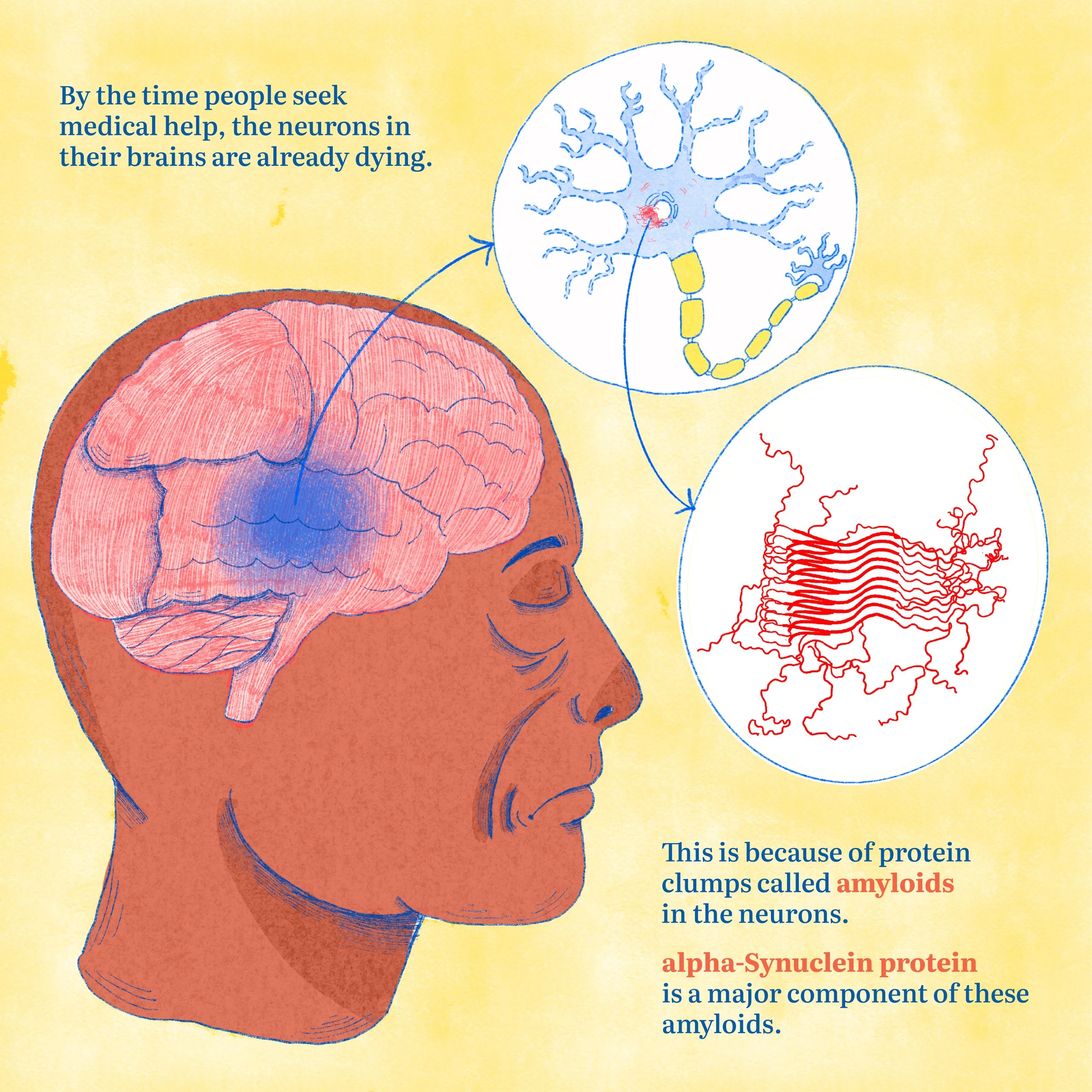 Parkinsons-Print-5.jpg