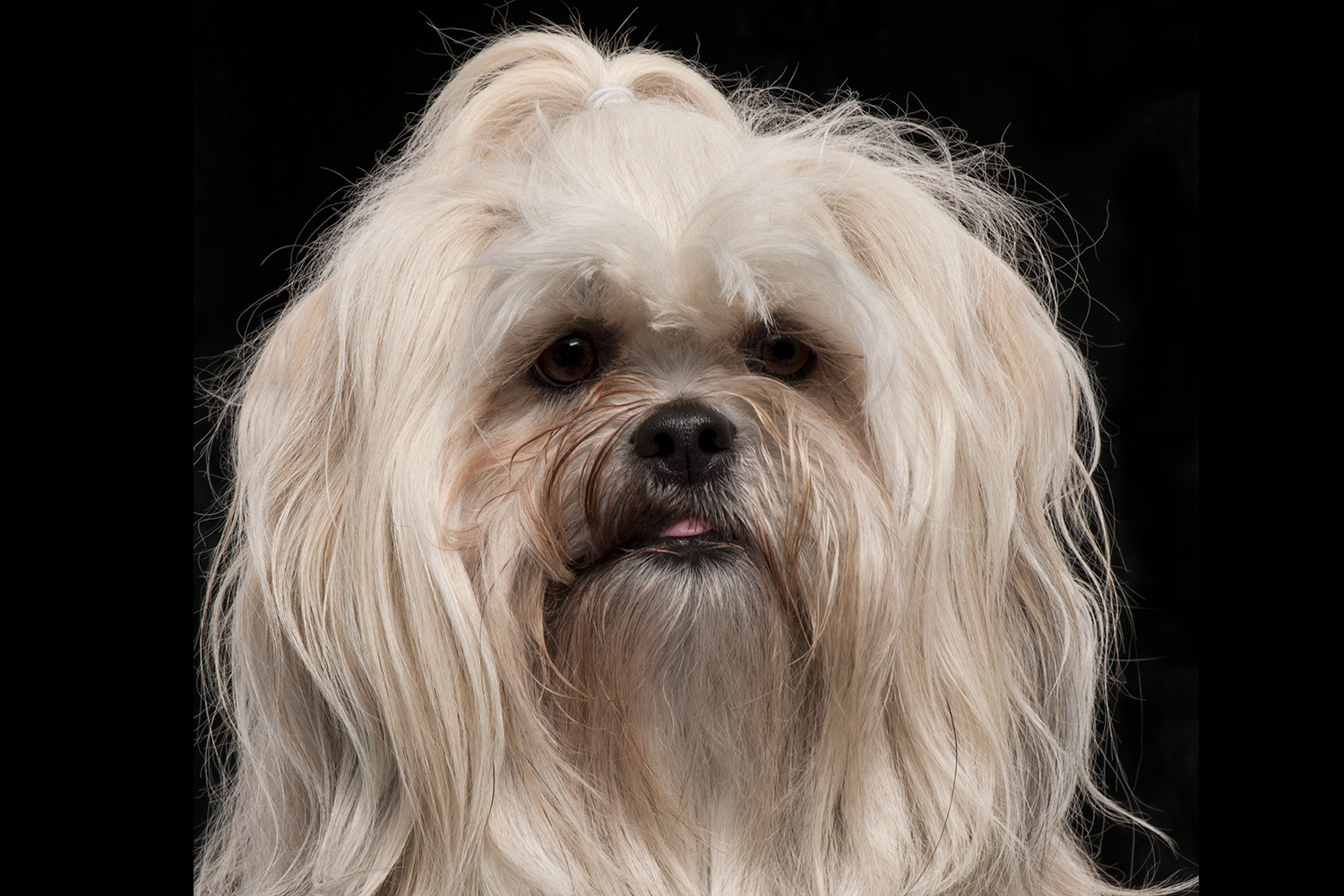 Back pain: A common problem