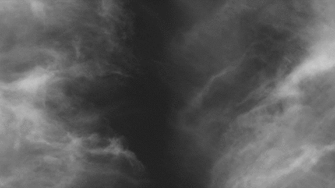 7 BW Loop.gif