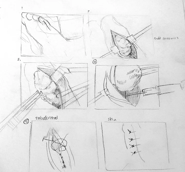 3. Thumbnails