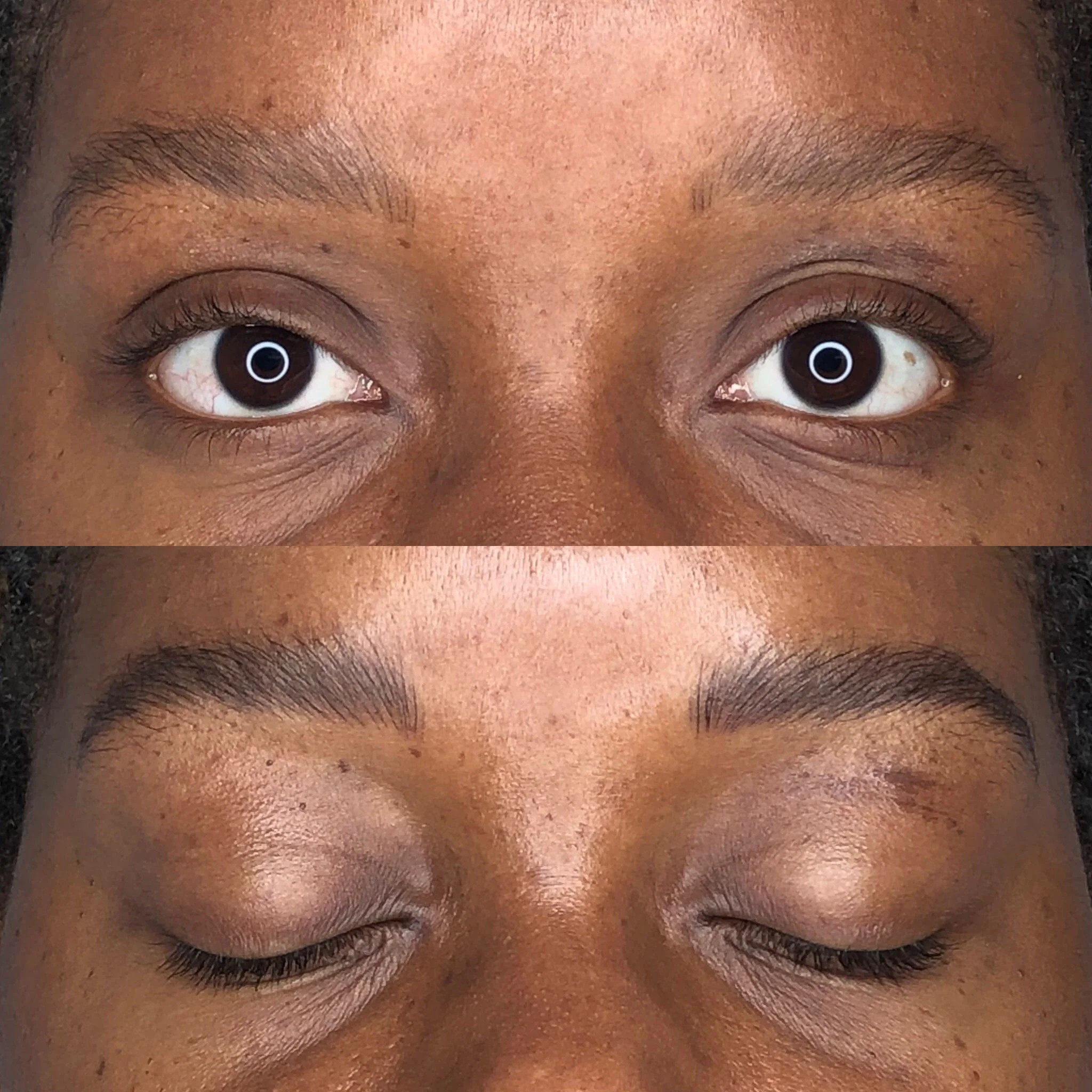 Before | After second session Combo Brow