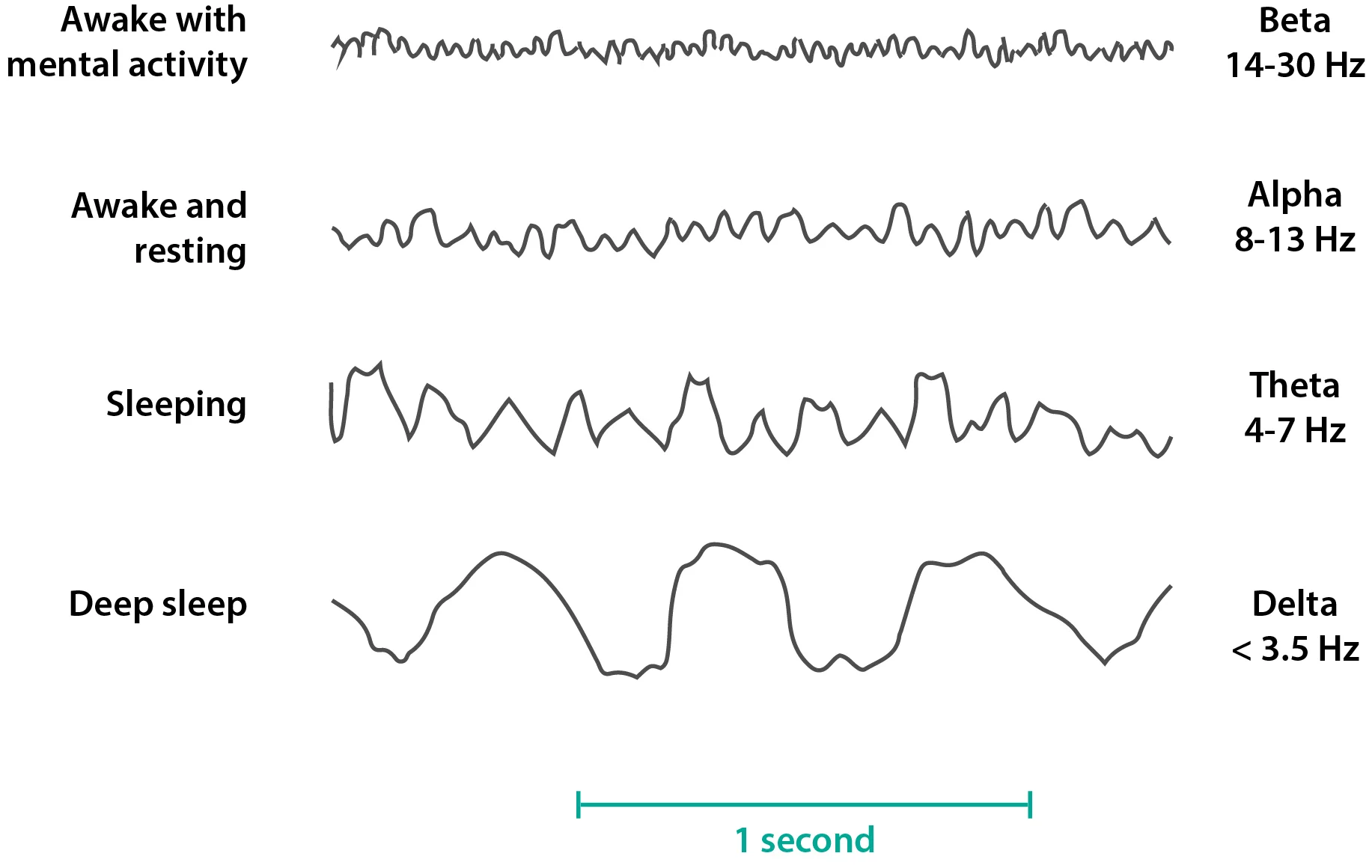 Eeg