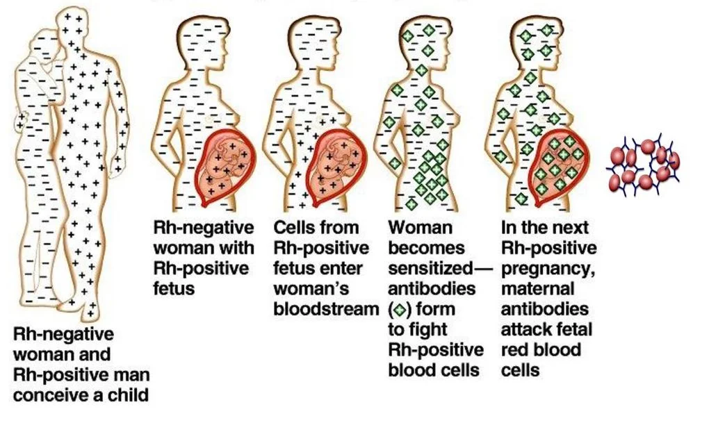 Coomb's Test Finding Bad Blood — Firstclass
