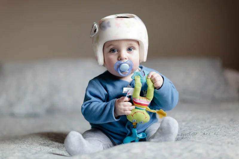 My baby has a flat head- Plagiocephaly