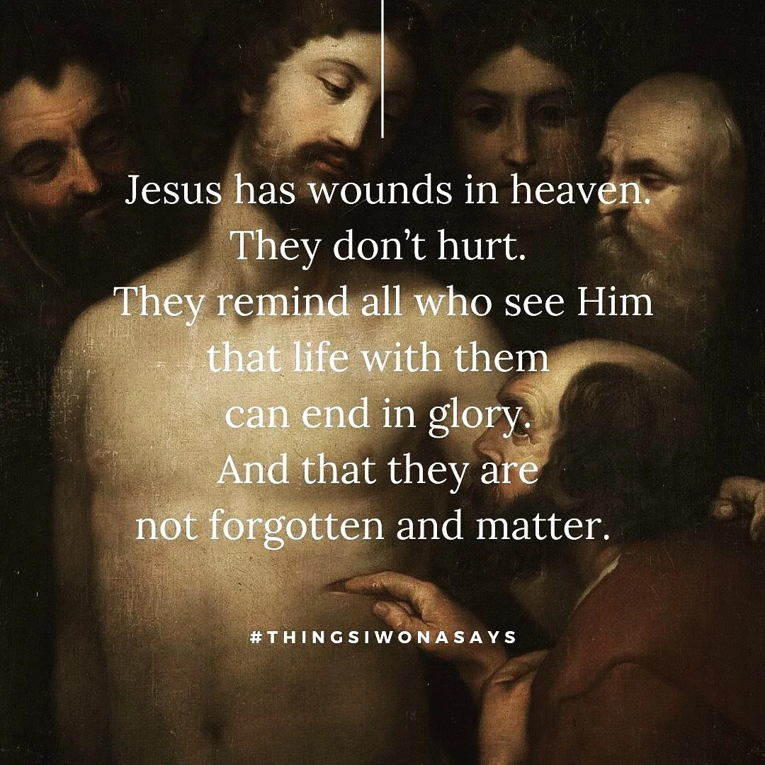 Wounds in heaven