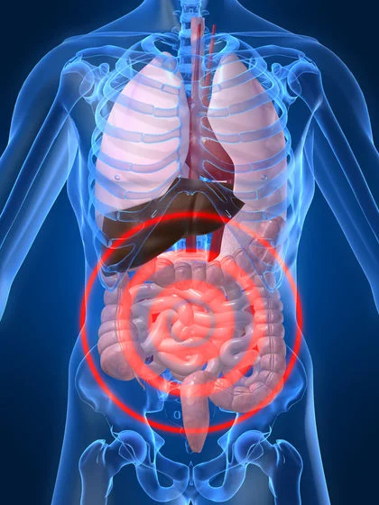 reoccuring_gut_infections.jpg