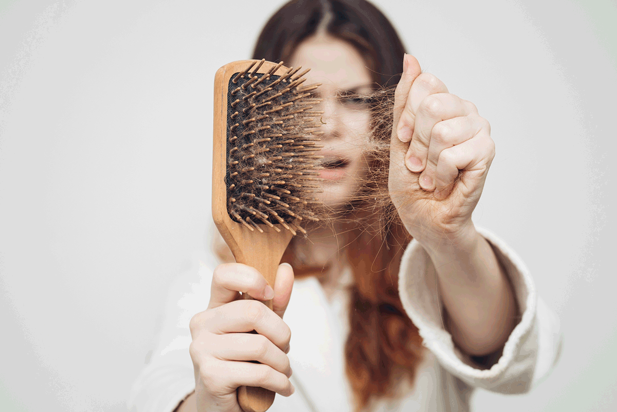 Hair-Loss.gif