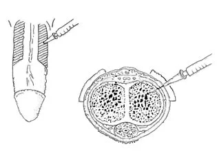inject-04.jpg