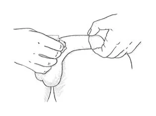 inject-05.jpg