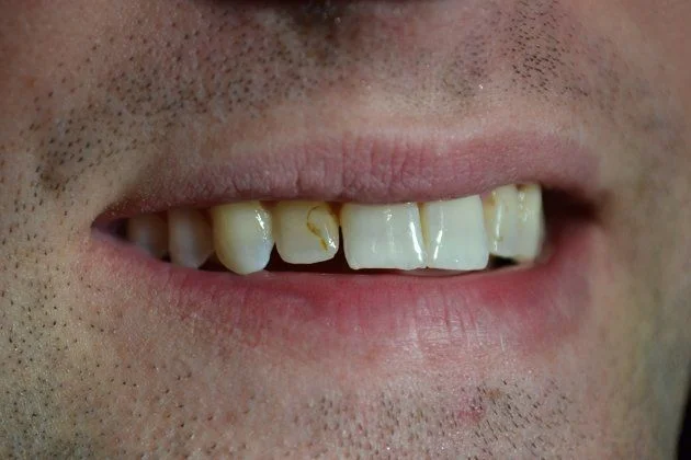 Before