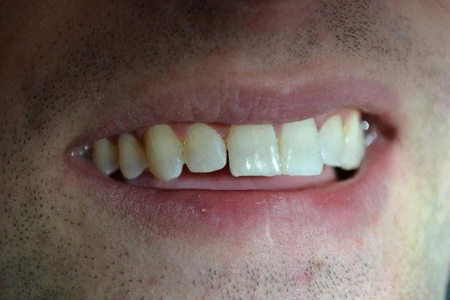 After