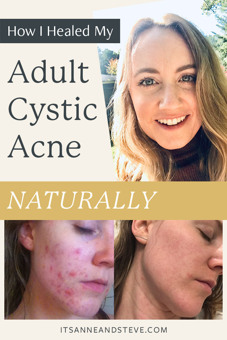 3 Kinds Of Acne: what to do: Which One Will Make The Most Money?