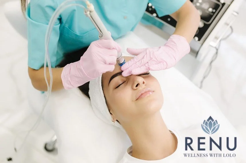 Monthly Microdermabrasion