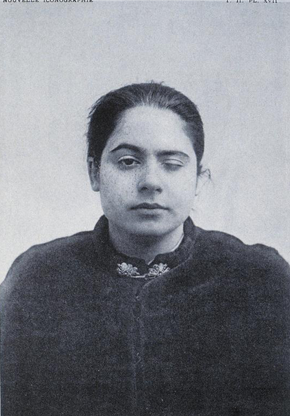 Trauma-and-BPD-Melbourne-Images-from-the-Salpetriere