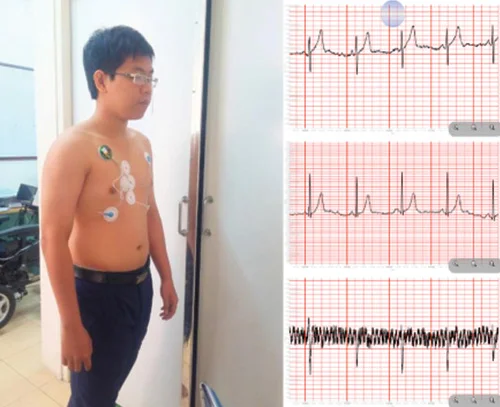 Máy dùng khi bệnh nhân đứng.