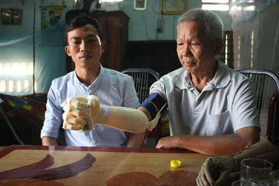 Chàng sinh viên xứ Quảng mang "bàn tay robot" chi phí 3 triệu đồng đến với người khuyết tật nghèo