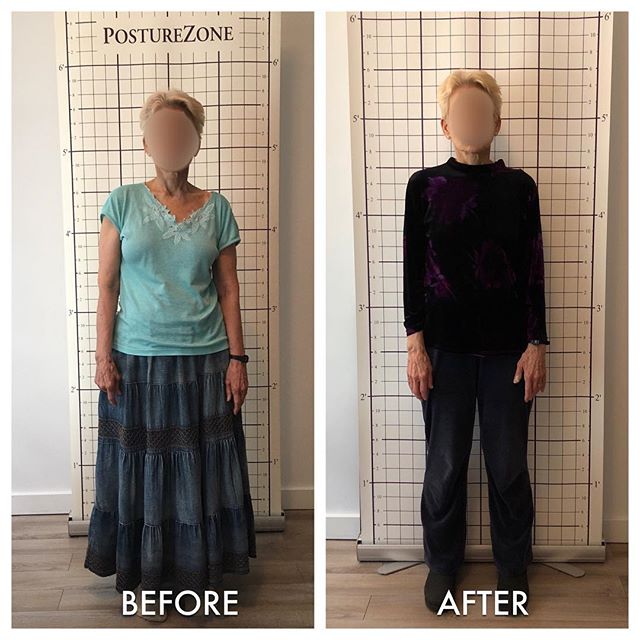 It&rsquo;s never too late to improve your posture and muscle function! My 76 yr. old client exhibiting the benefits of Posturology and Muscle Activation Techniques.