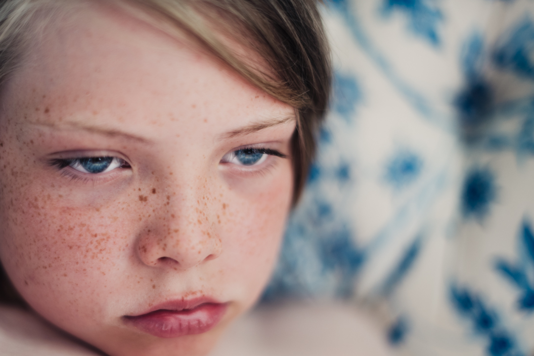 Björn Freckle-9.jpg