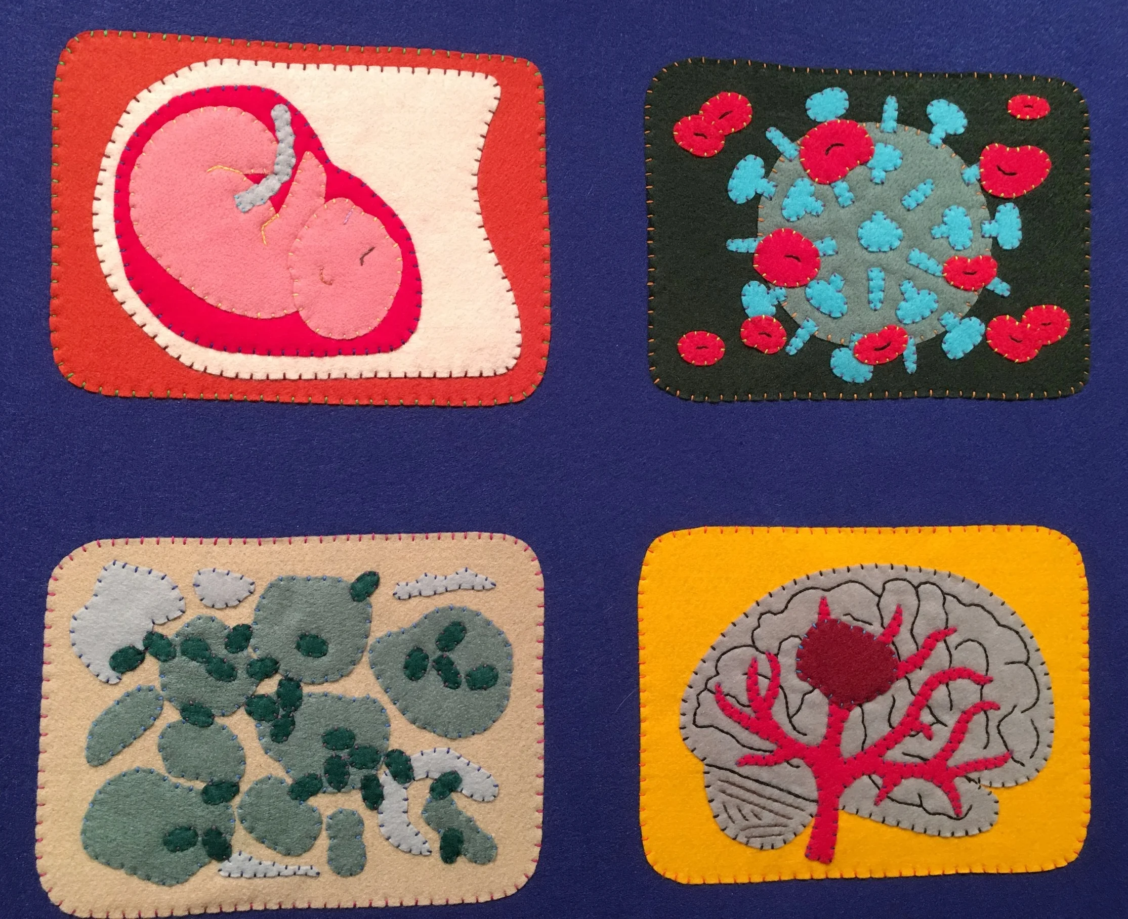  Conditions depicted (clockwise from upper-left): pregnancy, HIV,&nbsp;pneumocystis pneumonia, and stroke.&nbsp; 